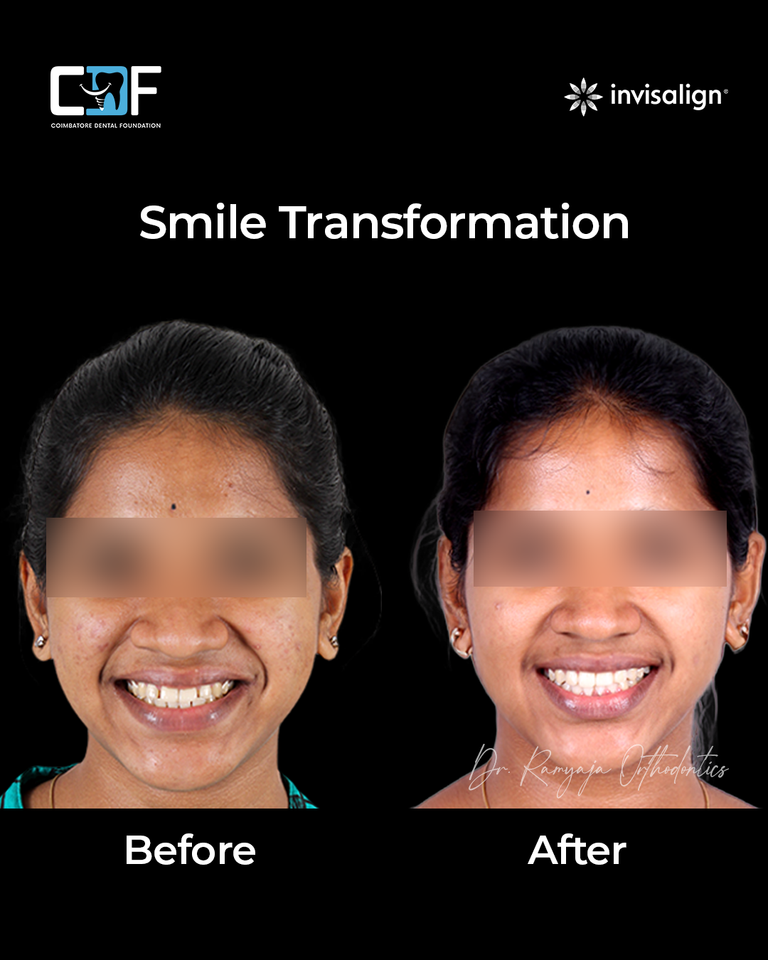 Before After Result